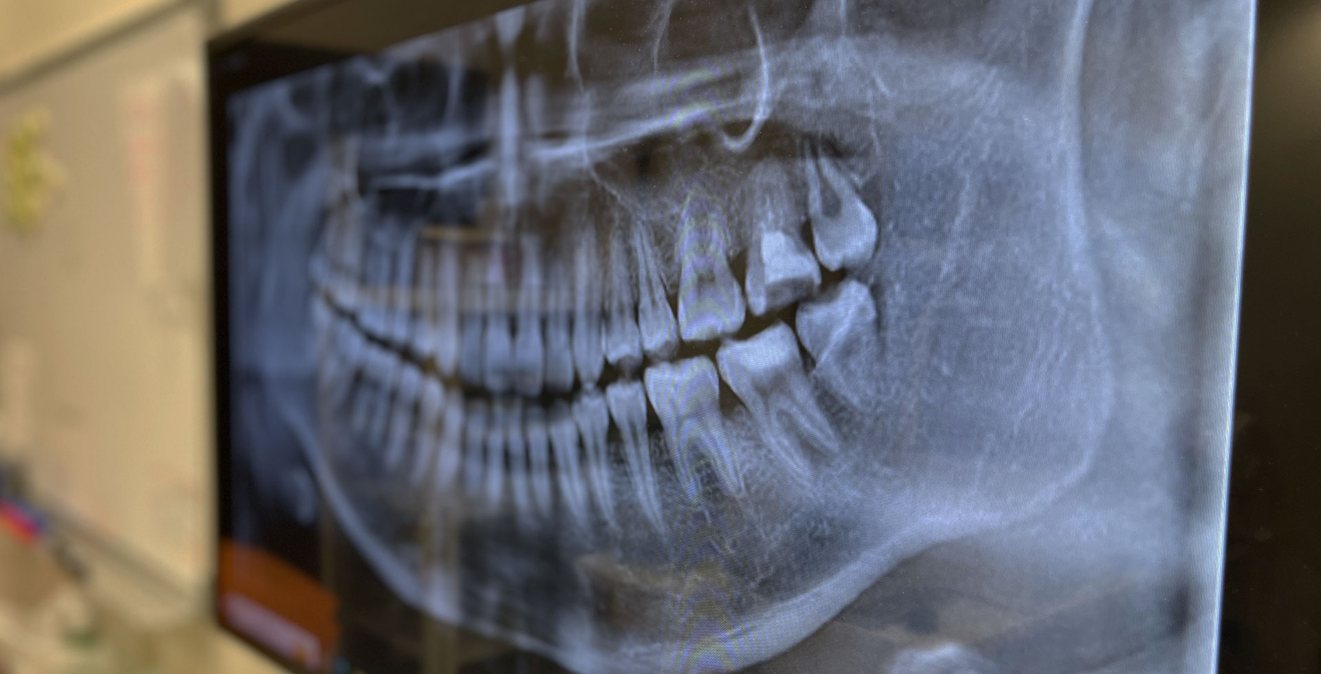 湘南台駅西口から徒歩3分の歯科・歯医者「湘南台いつき歯科」は、急患も大歓迎です。急な痛みが出たら我慢せずぜひ当院へお越しください。